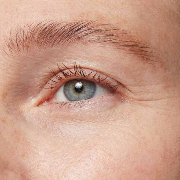fine lines
