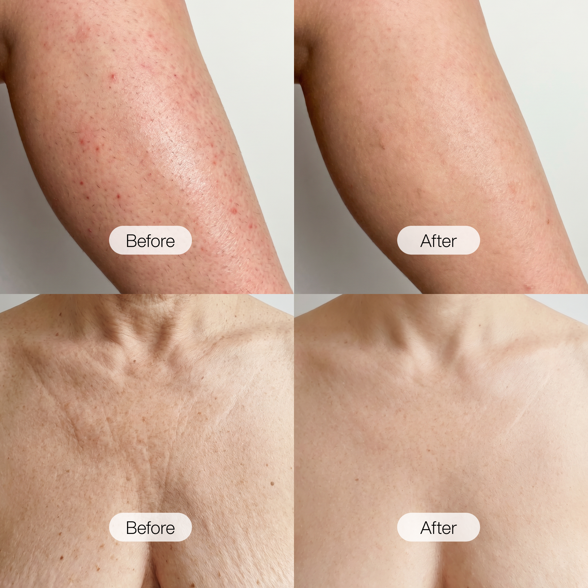 Tighten & Tone Body Cream